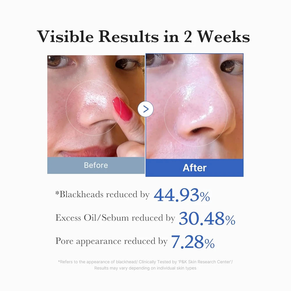 Medicube Zero Pore Exfoliating Pads